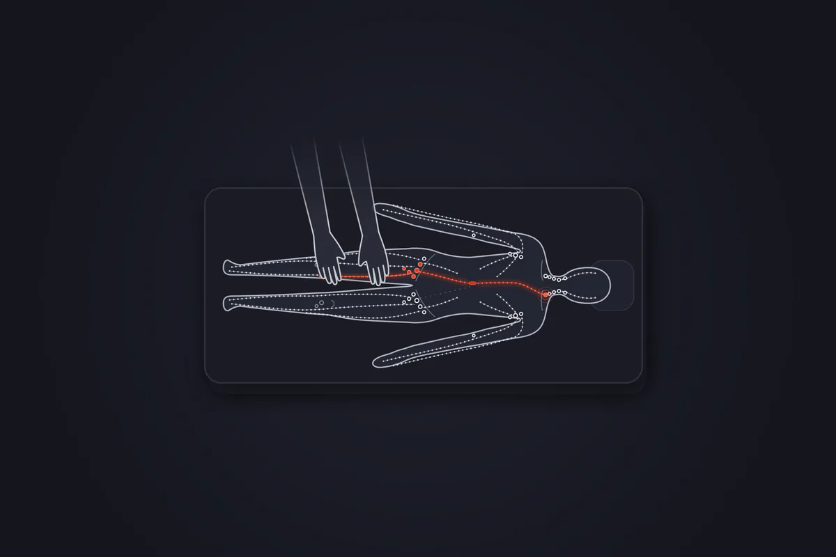 Illustration&nbsp;: patient allongé sur le dos, vu de dessus, mains d'un kinésithérapeute sur la cuisse droite&nbsp;; un tracé rouge suit la lymphe de la jambe par les ganglions de l'aine jusqu'à la base du cou, côté gauche.
