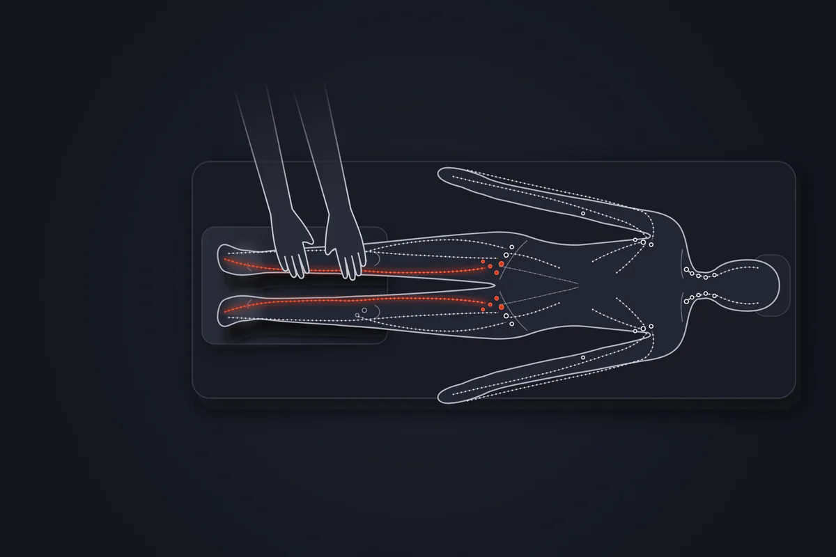 Illustration&nbsp;: patient allongé sur le dos, vu de dessus, les mollets et les pieds posés sur un coussin qui surélève les jambes, chevilles légèrement gonflées. Les mains du kiné sont posées sur le mollet droit. Sur chaque jambe, un tracé rouge suit la face interne, du pied jusqu'aux ganglions de l'aine&nbsp;; le reste du réseau lymphatique est dessiné en pointillés gris.