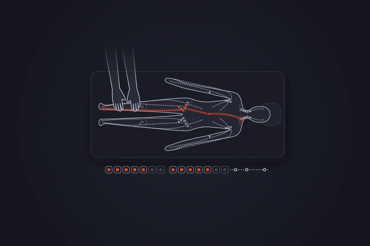 Illustration&nbsp;: patient allongé sur une table de soin vu de dessus, mains du kinésithérapeute posées sur le mollet droit, sous le genou. Un trajet lymphatique rouge monte du pied vers les ganglions de l'aine, puis jusqu'à la base du cou. Sous la table, une frise montre un exemple de phase intensive (deux semaines, cinq jours sur sept), suivie de séances d'entretien plus espacées.