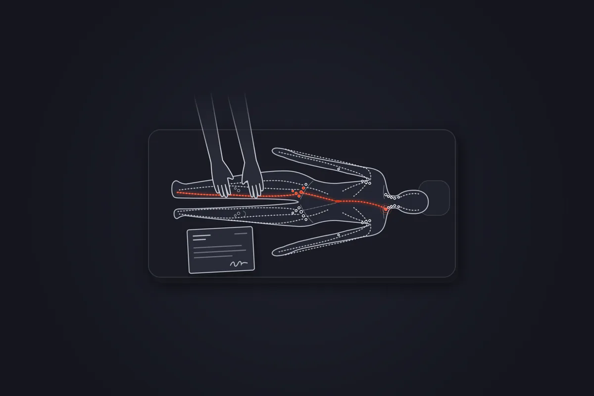 Illustration&nbsp;: patient allongé sur une table de soin, vu de dessus, avec une jambe droite plus volumineuse que la gauche, pied compris (lymphœdème). Les mains du kinésithérapeute sont posées sur cette jambe, et le trajet de la lymphe est tracé en rouge du pied jusqu'à la base du cou. Une ordonnance vierge est posée sur la table.
